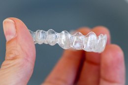 A Brutally Honest Review of Invisalign