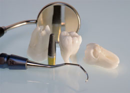 Are Dental Implants Safe?