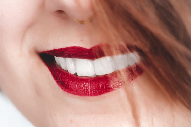 How does Teeth Whitening Work?