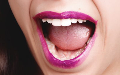 Professional Teeth Whitening Methods