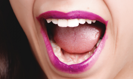 Professional Teeth Whitening Methods