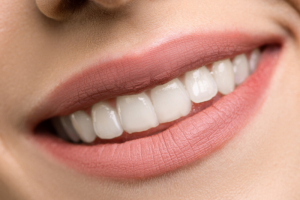 Reasons for Dental Implant Failure