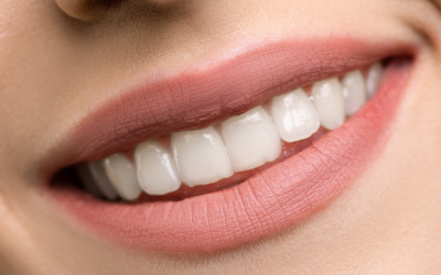 Reasons for Dental Implant Failure